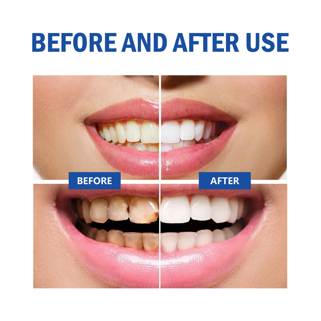 Teeth Whitening Powder Remove Plaque Stains Toothpaste Fresh Breath Protect Gum Health Deep Cleaning Teeth Healthy Care